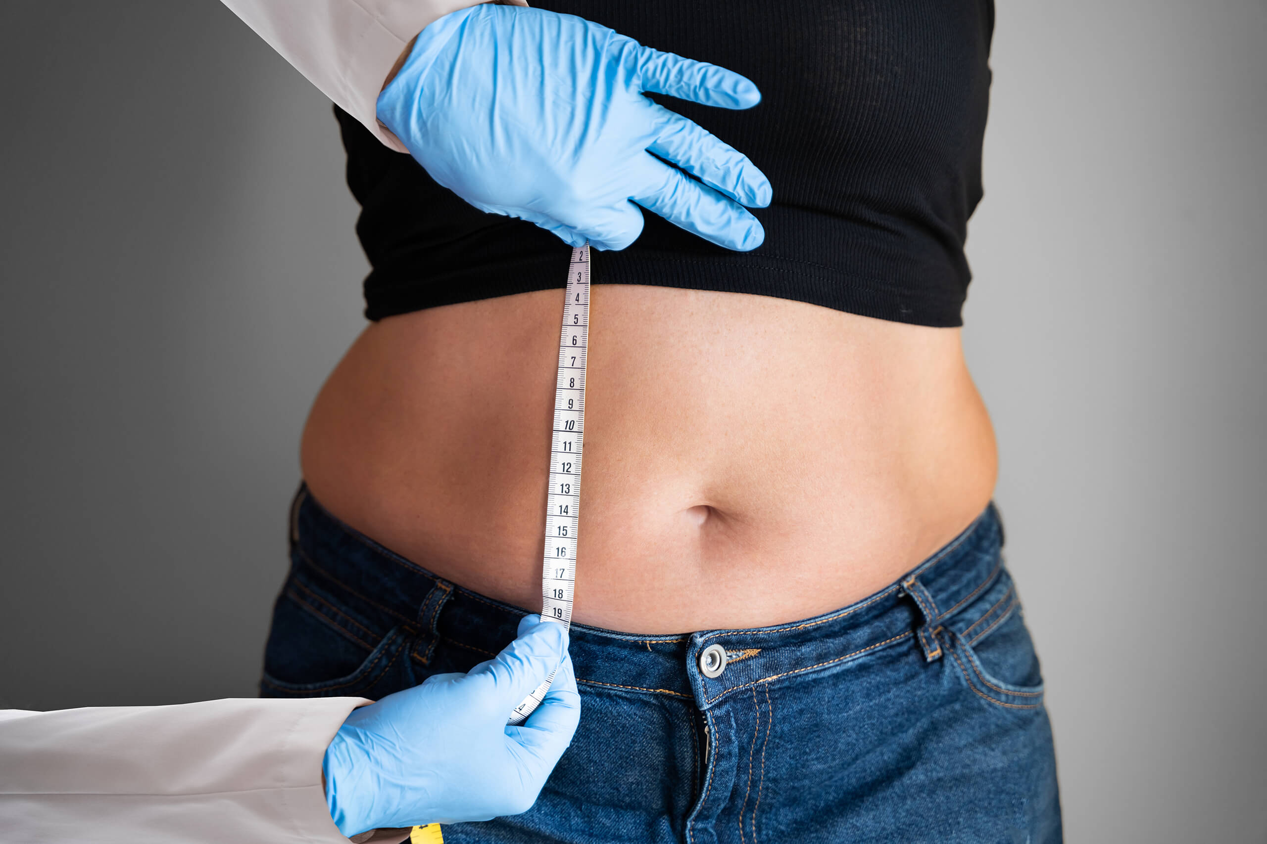 A doctor measures a woman's abdomen vertically prior to an abdominoplasty.
