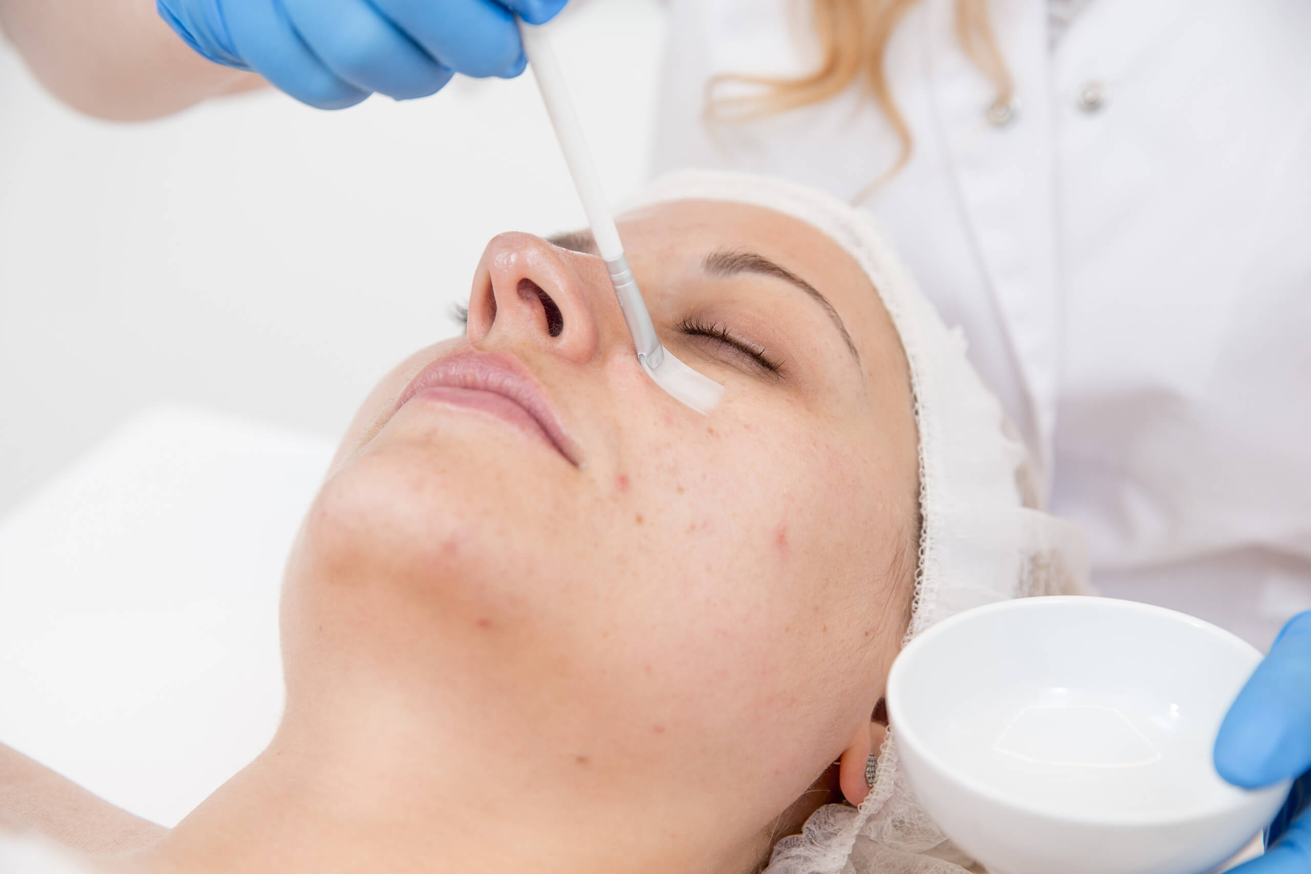 A woman gets a chemical peel at a dermatologist's office