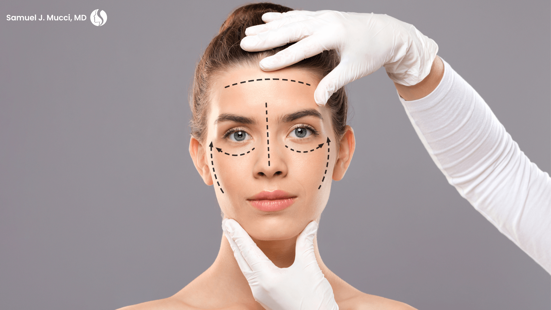 facial rejuvenation with Dr. Mucci