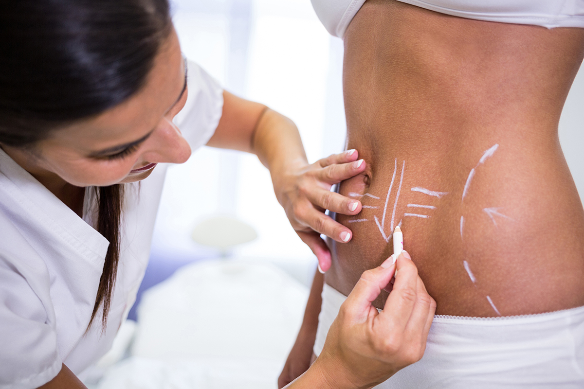 Woman receiving body contouring and liposuction services
